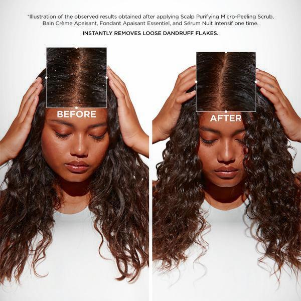 Micro-Peeling Cellulaire 6.8oz