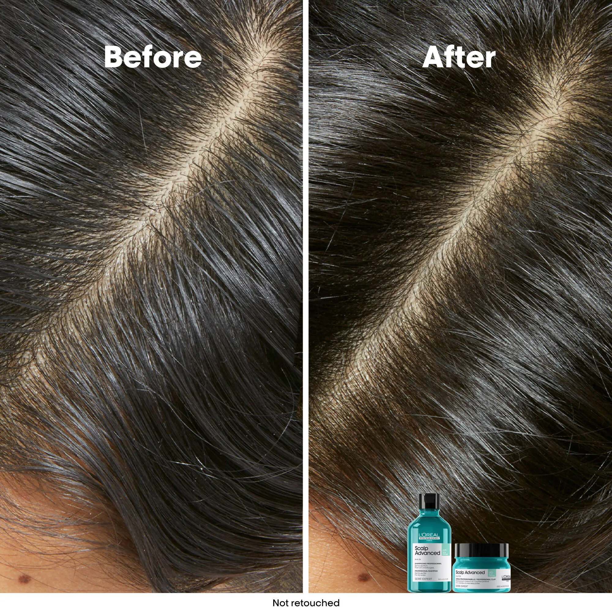Scalp Advanced Anti-Oiliness Shampoo 500mL