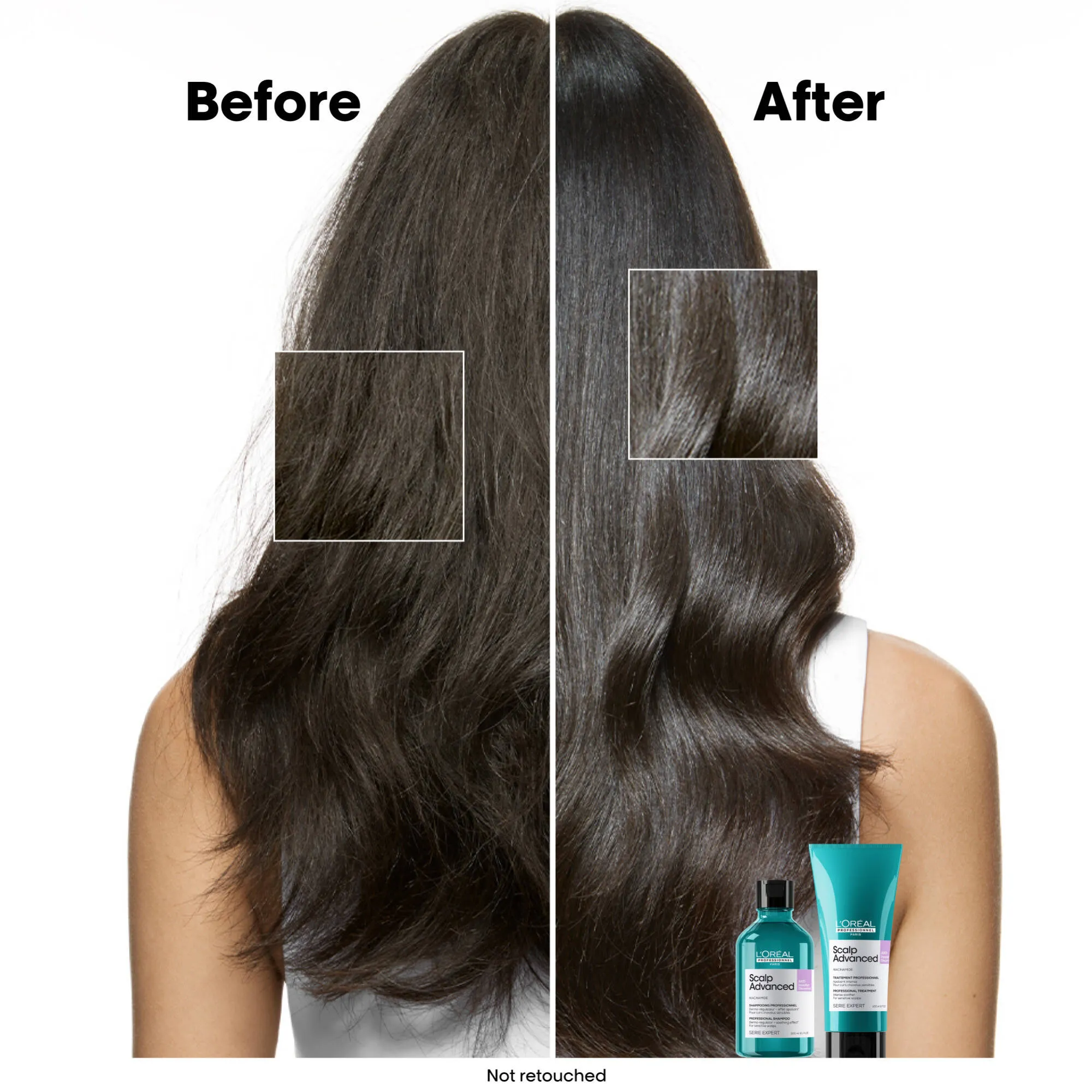 Scalp Advanced Anti-Discomfort Shampoo Refill 500mL