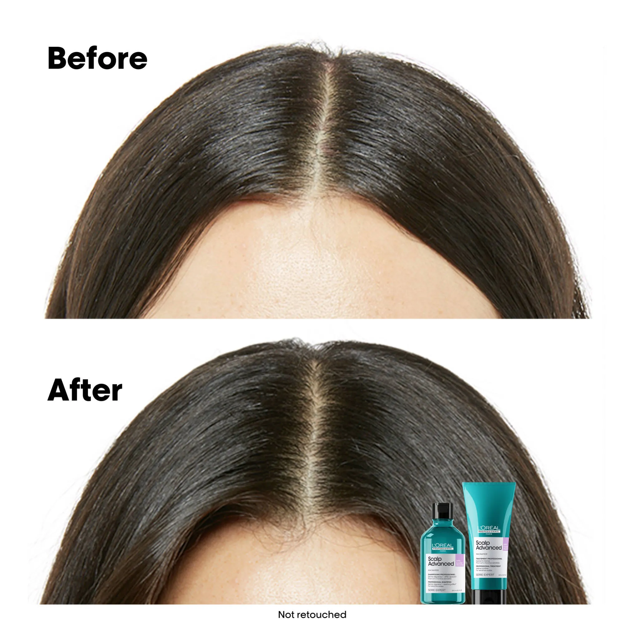 Scalp Advanced Anti-Discomfort Shampoo Refill 500mL